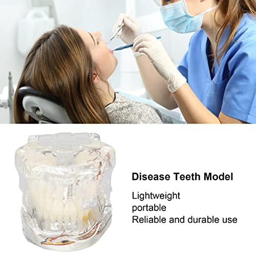 מודל שיניים משתל למחלות, לימוד מודל שיני מחלות למעבדה